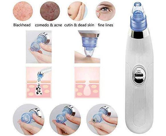 Blackhead Removal Machine | Derma Suction 3 In 1 Black Head Remover Machine | Acne Pimple Pore Cleaner Vacuum Suction Tool - Image 4